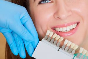 Which Teeth Whitening Methods Suits You?