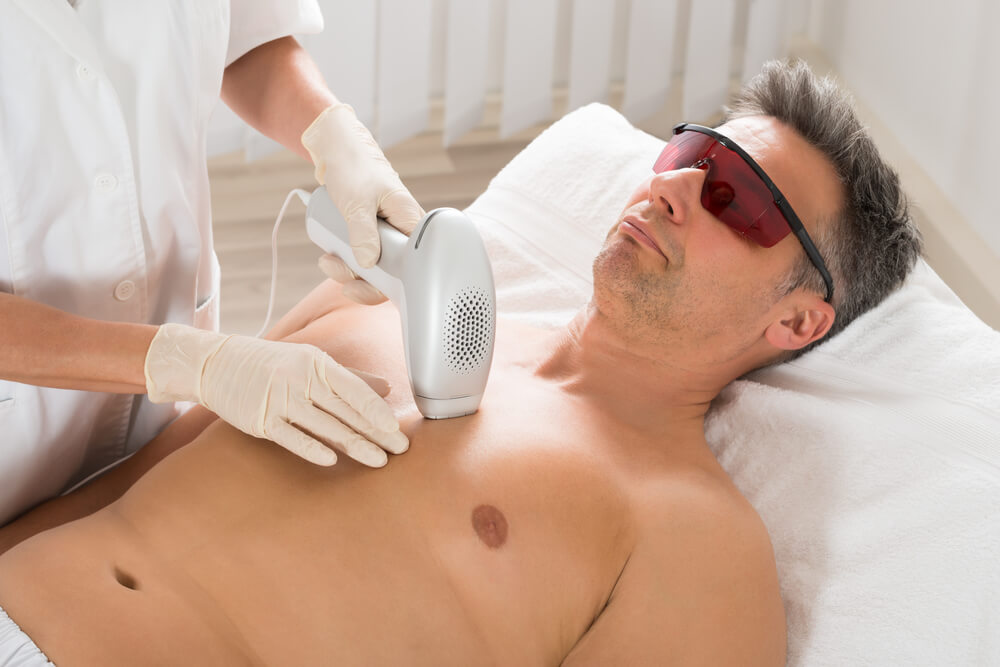 Say Goodbye To Unwanted Hair: Laser Hair Removal 101